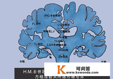 他的记忆只要7秒 却不断认识本身的老婆（下）