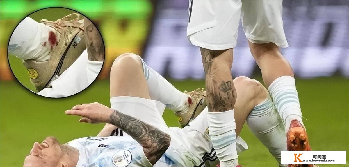 跑步者帮忙梅西获得世界杯冠军！洛塞尔索的受伤是阿根廷的隐患