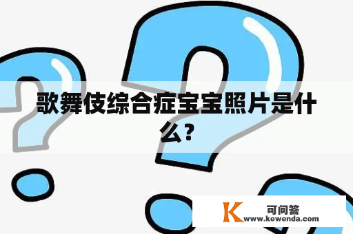 歌舞伎综合症宝宝照片是什么？