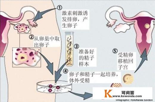 做试管婴儿的流程是怎样的_你心目中的十大经典动漫是哪些