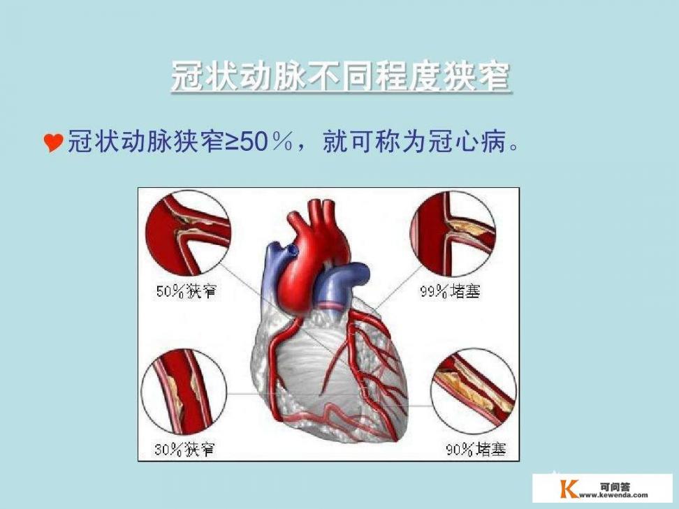 心绞痛的必然结果是心脏搭桥，心绞痛的本质是什么？