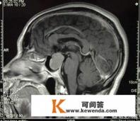 人类突然变成巨人会怎样