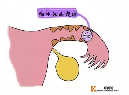 宫处孕能不能再怀孕